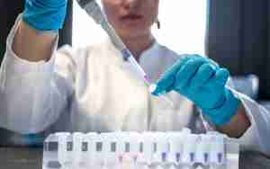 lab tests Immigration Medical Exams & Physicals Milpitas, San Jose, Silicon Valley , SF Bay Area CA uscisclinic.com