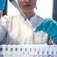 lab tests Immigration Medical Exams & Physicals Milpitas, San Jose, Silicon Valley , SF Bay Area CA uscisclinic.com
