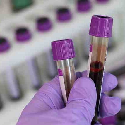 uscis-clinic-labs